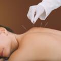 What is Acupuncture and How Does It Work?